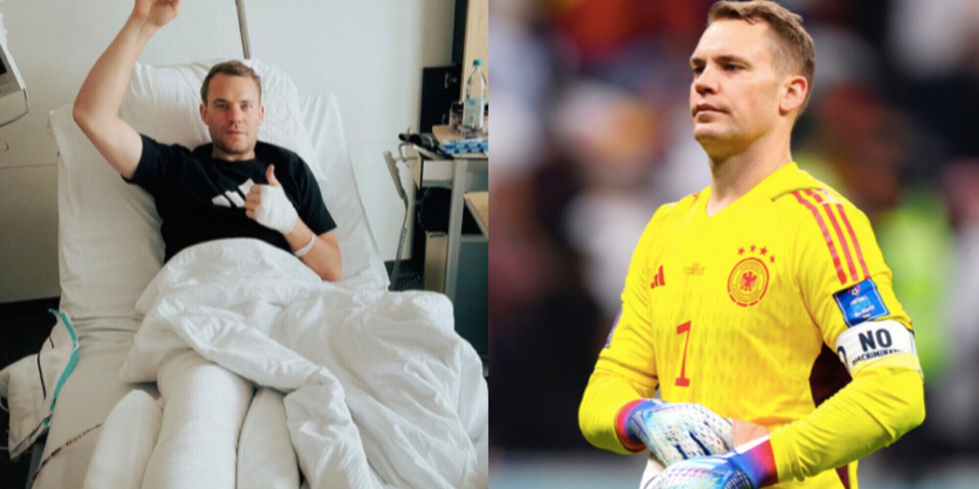 Neuer, incidente sugli sci: stagione finita