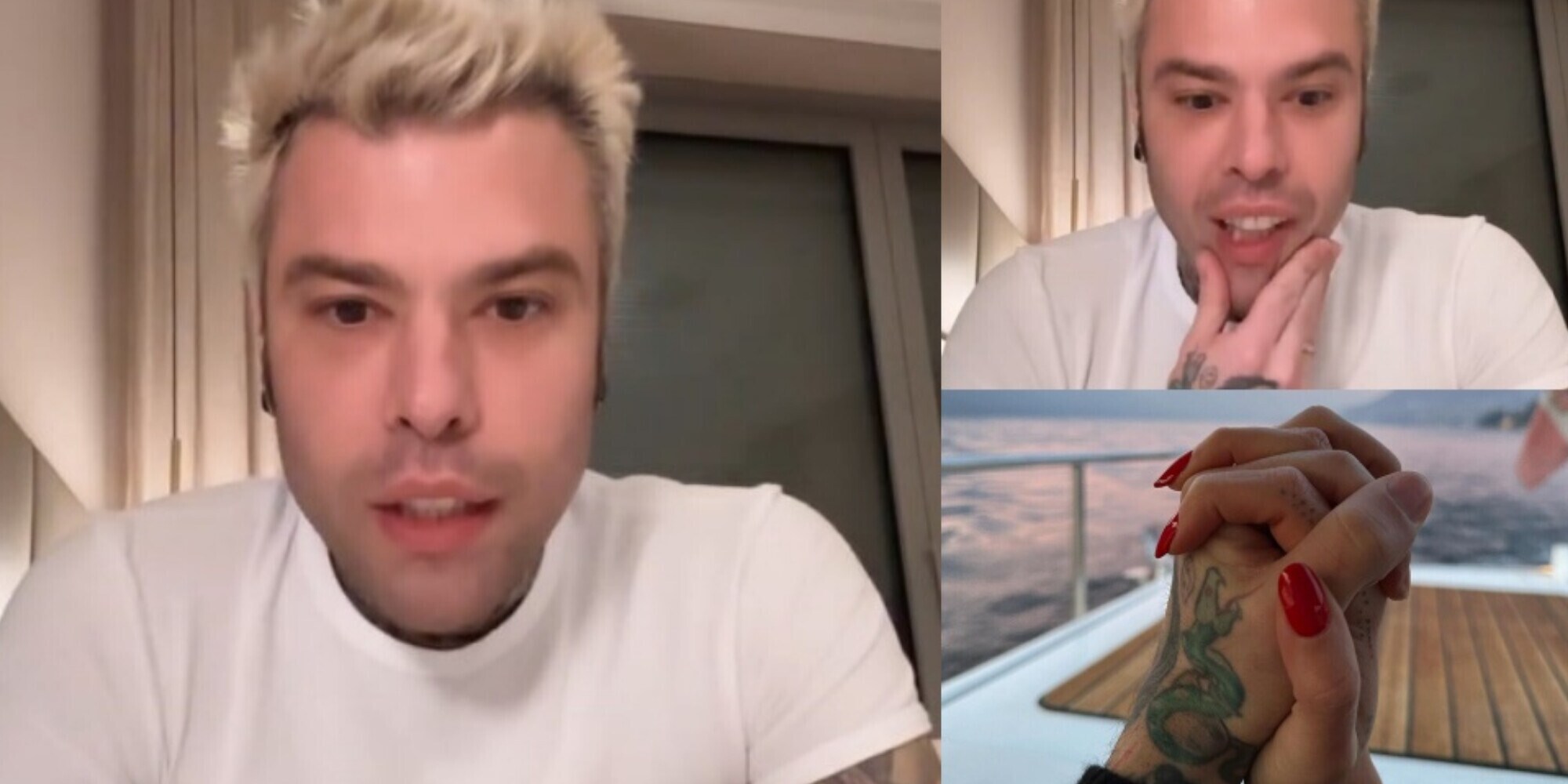 Fedez, confessioni inaspettate: la verità su salute e Chiara Ferragni