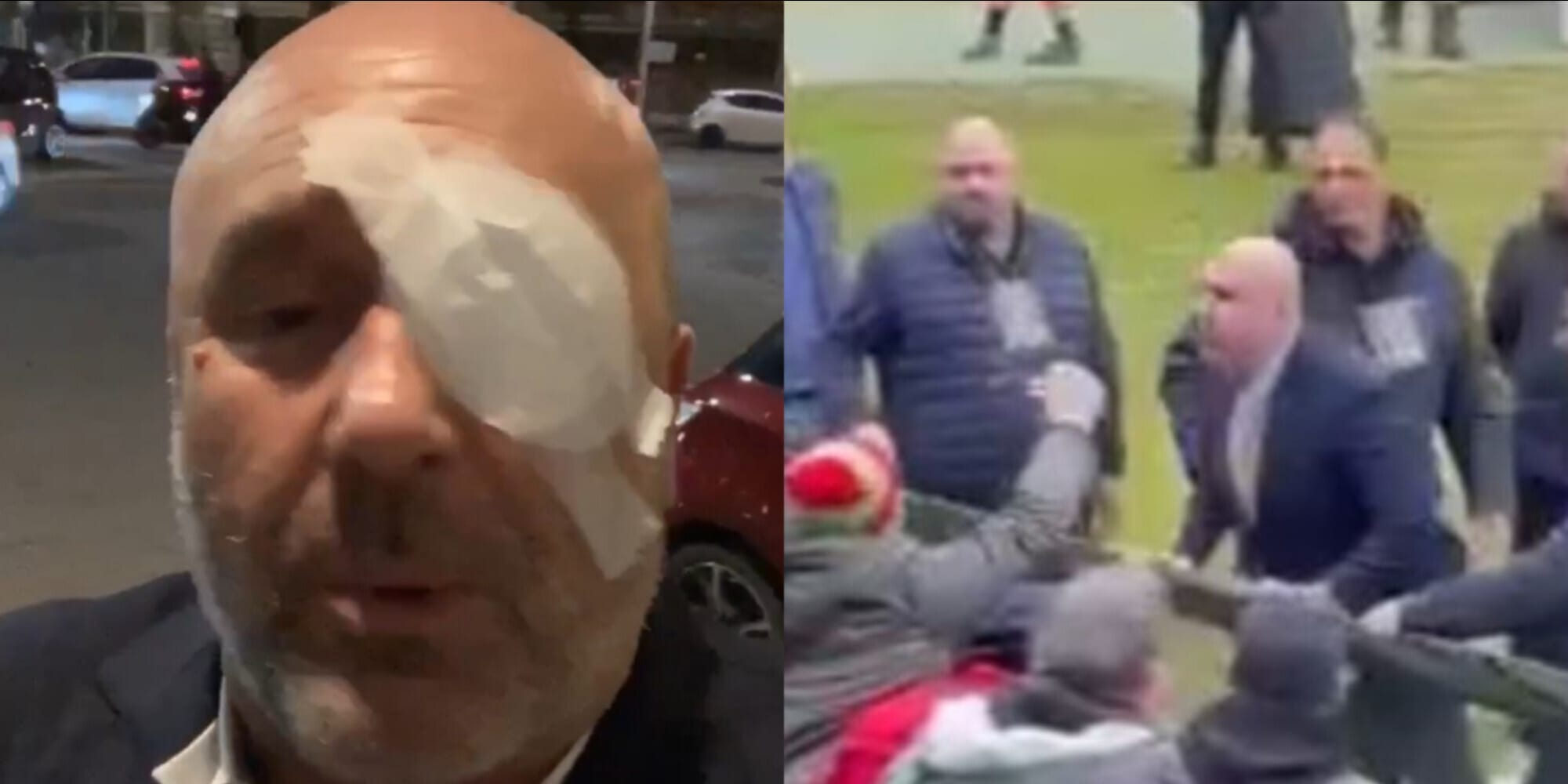 Ternana, Bandecchi shock: "Mi hanno spappolato l'occhio", poi rivela: "Scherzo"