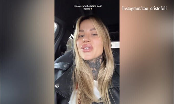 Zoe Cristofoli si sfoga: "C'è gente che si rifà dalla testa ai piedi"