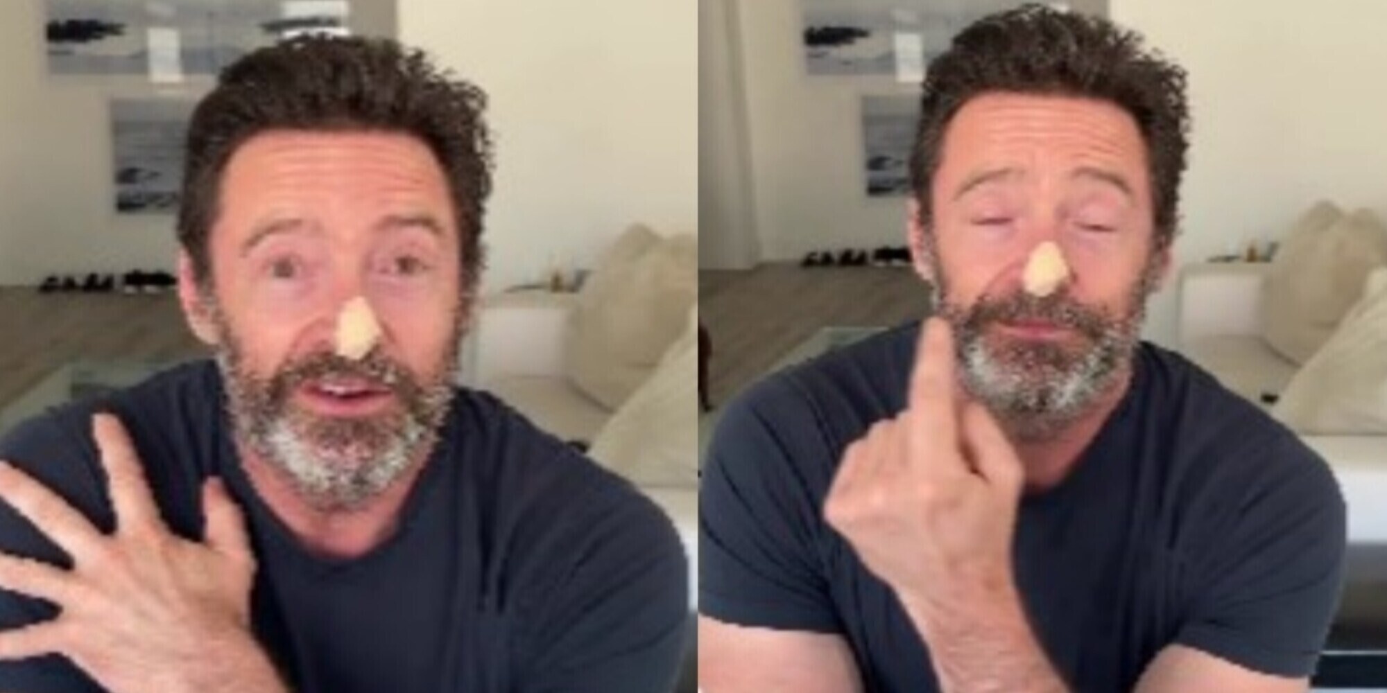 Hugh Jackman e il cancro della pelle. L'appello social dopo le visite