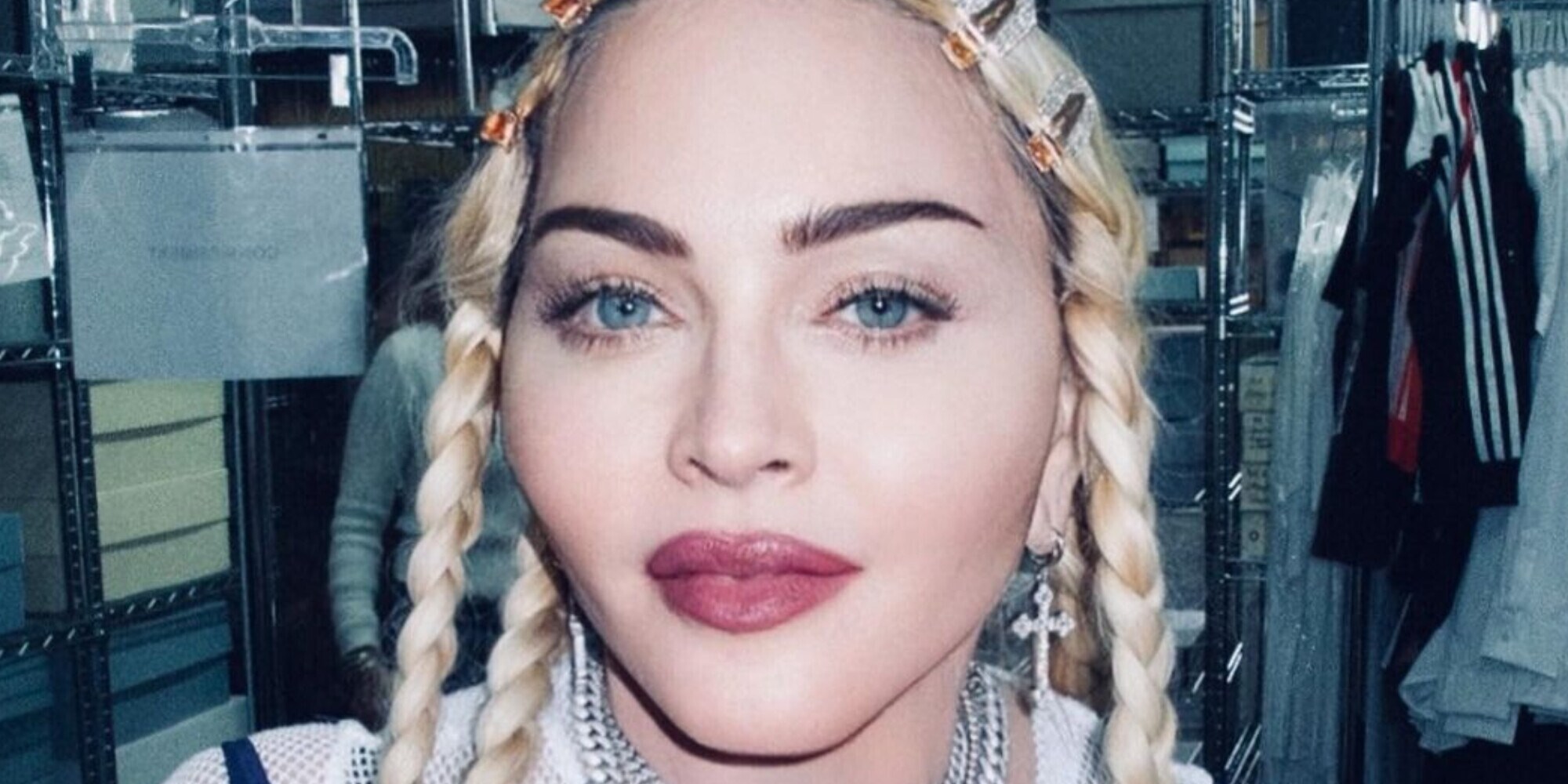 Madonna ricoverata in terapia intensiva: cosa è successo