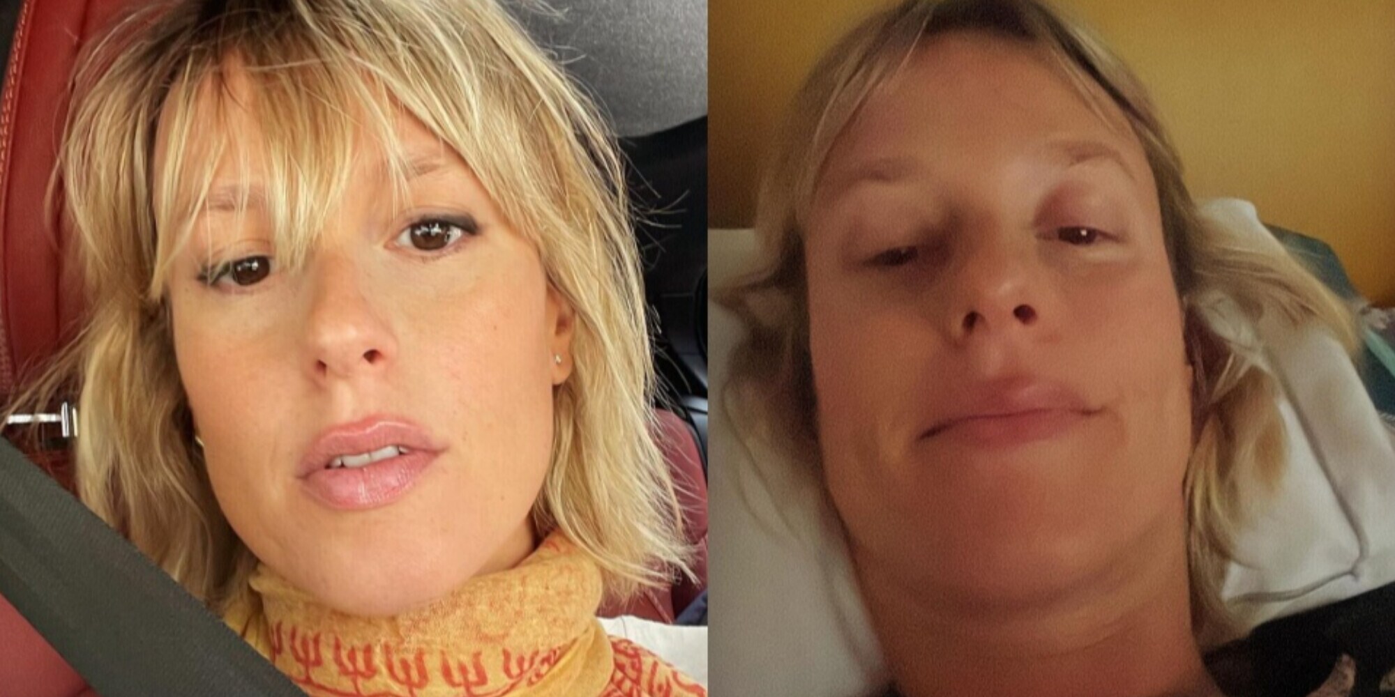 Federica Pellegrini, aggiornamenti dopo la caduta: come sta