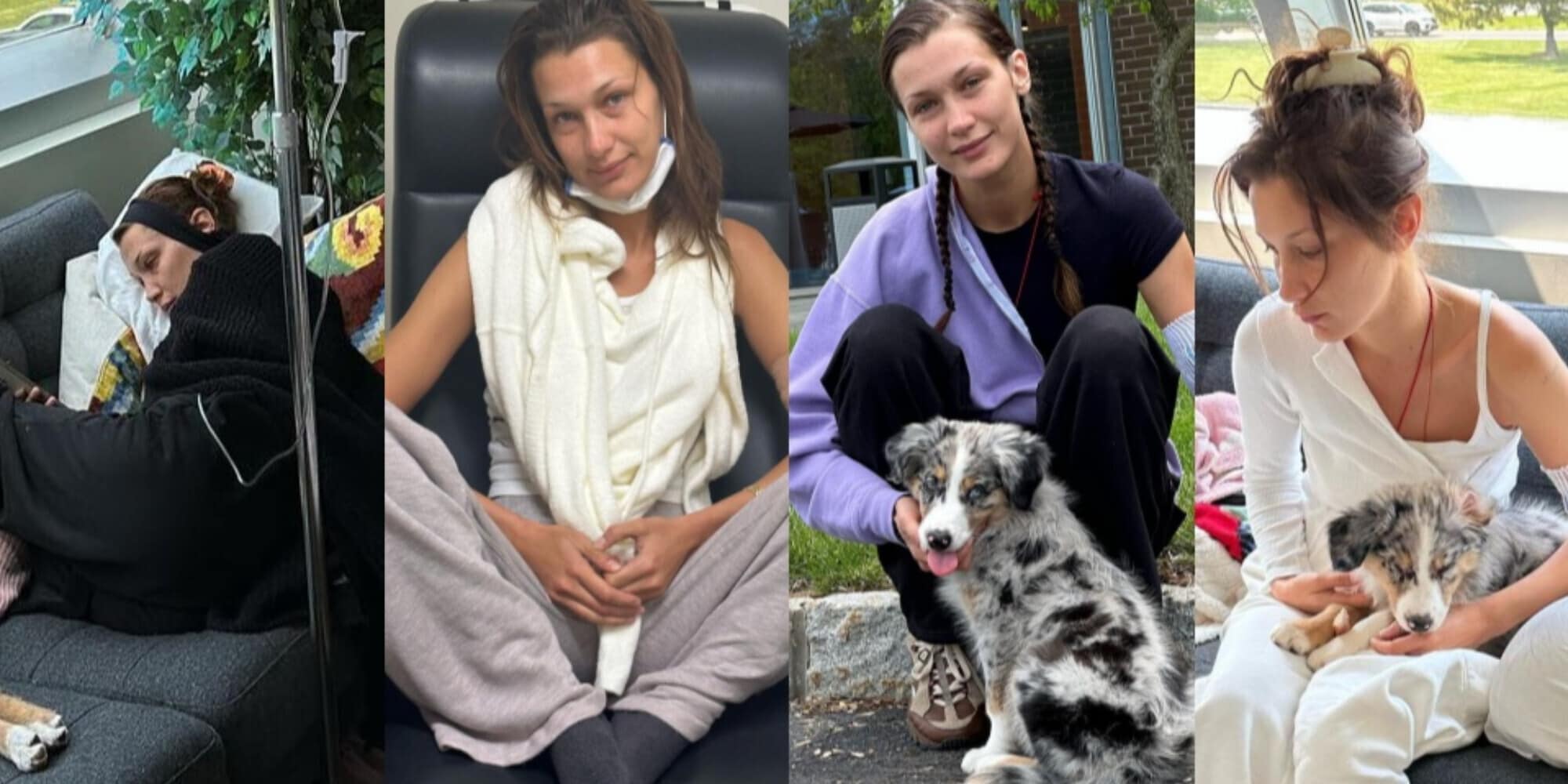 Bella Hadid, la malattia di Lyme e l'annuncio sui social