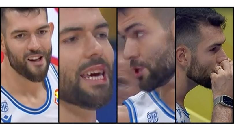Ricci, Italia-Usa a muso duro: gomitata e labbro sanguinante