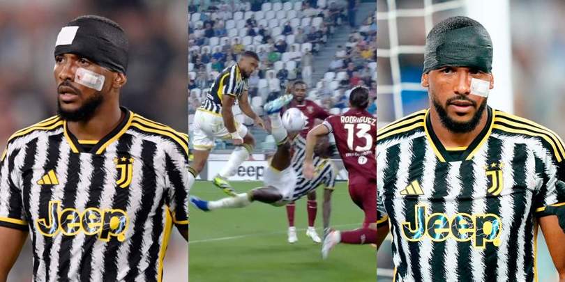 Kean trasforma Bremer in Chiellini: scarpata in faccia, che botta!
