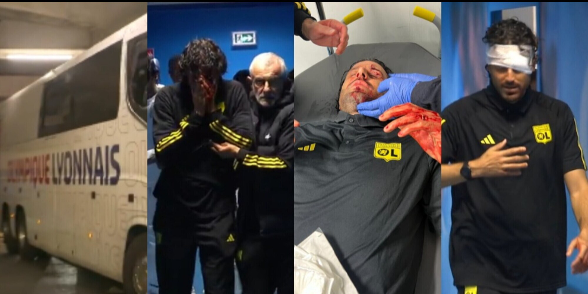 Grosso, una maschera di sangue: Francia sotto shock per Marsiglia-Lione