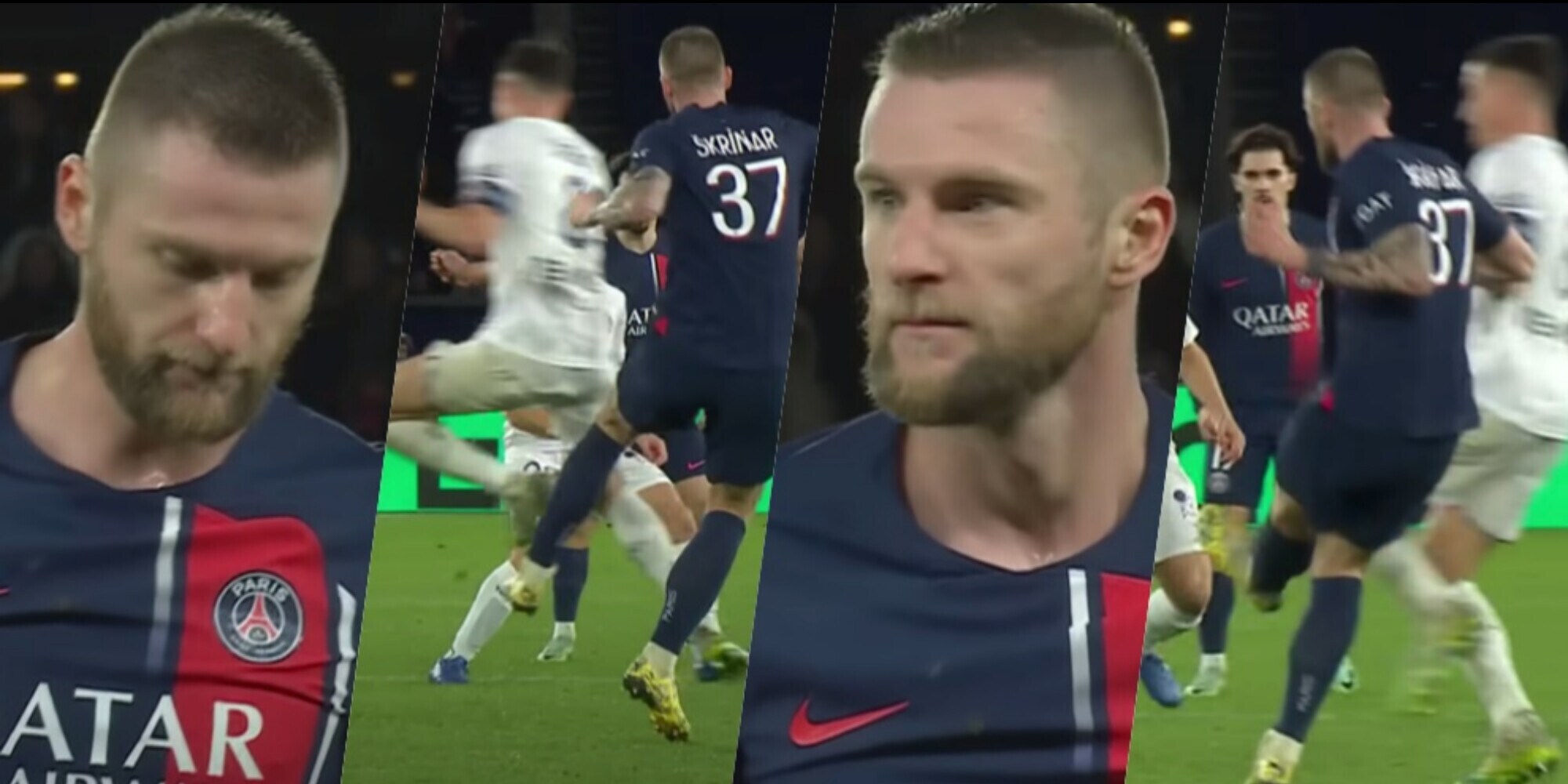 Skriniar ko alla caviglia in Psg-Tolosa: rischio operazione e lungo stop