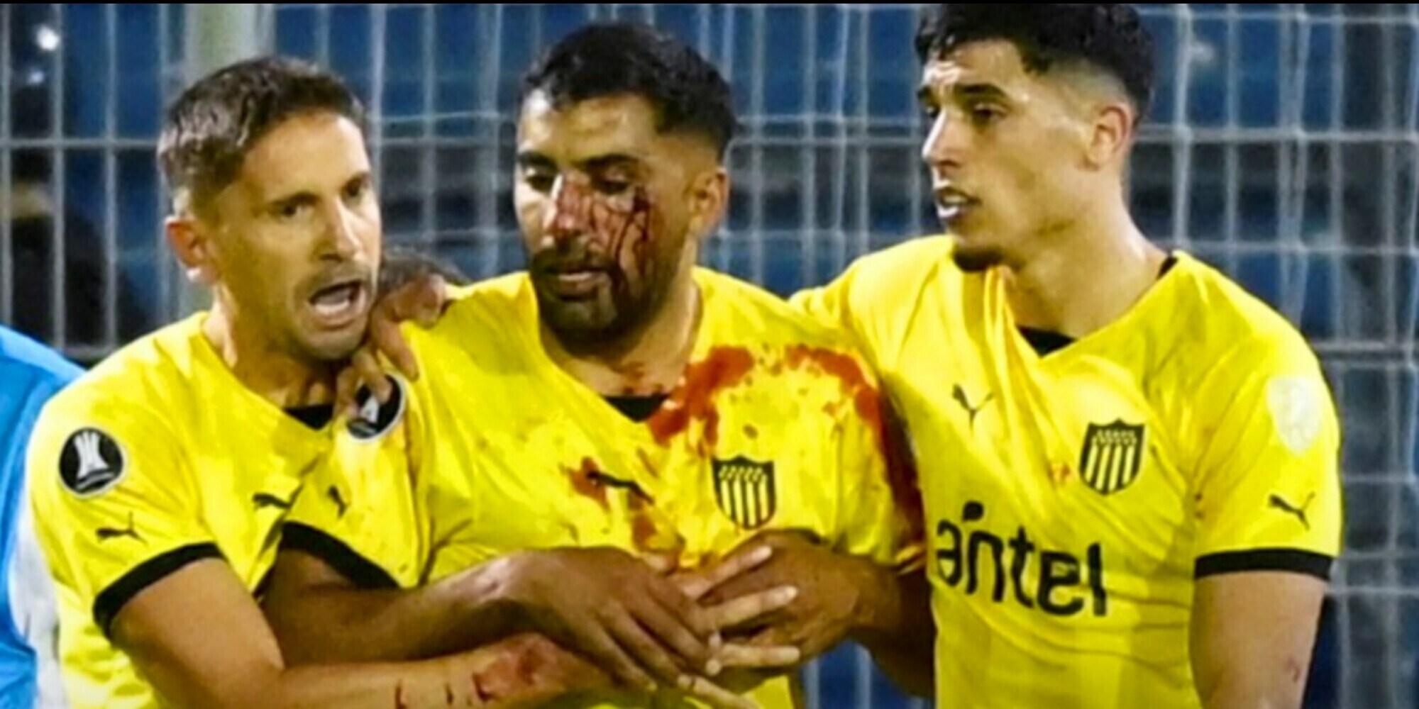 Uruguay sotto shock, l’ex Fiorentina è una maschera di sangue: cosa è successo
