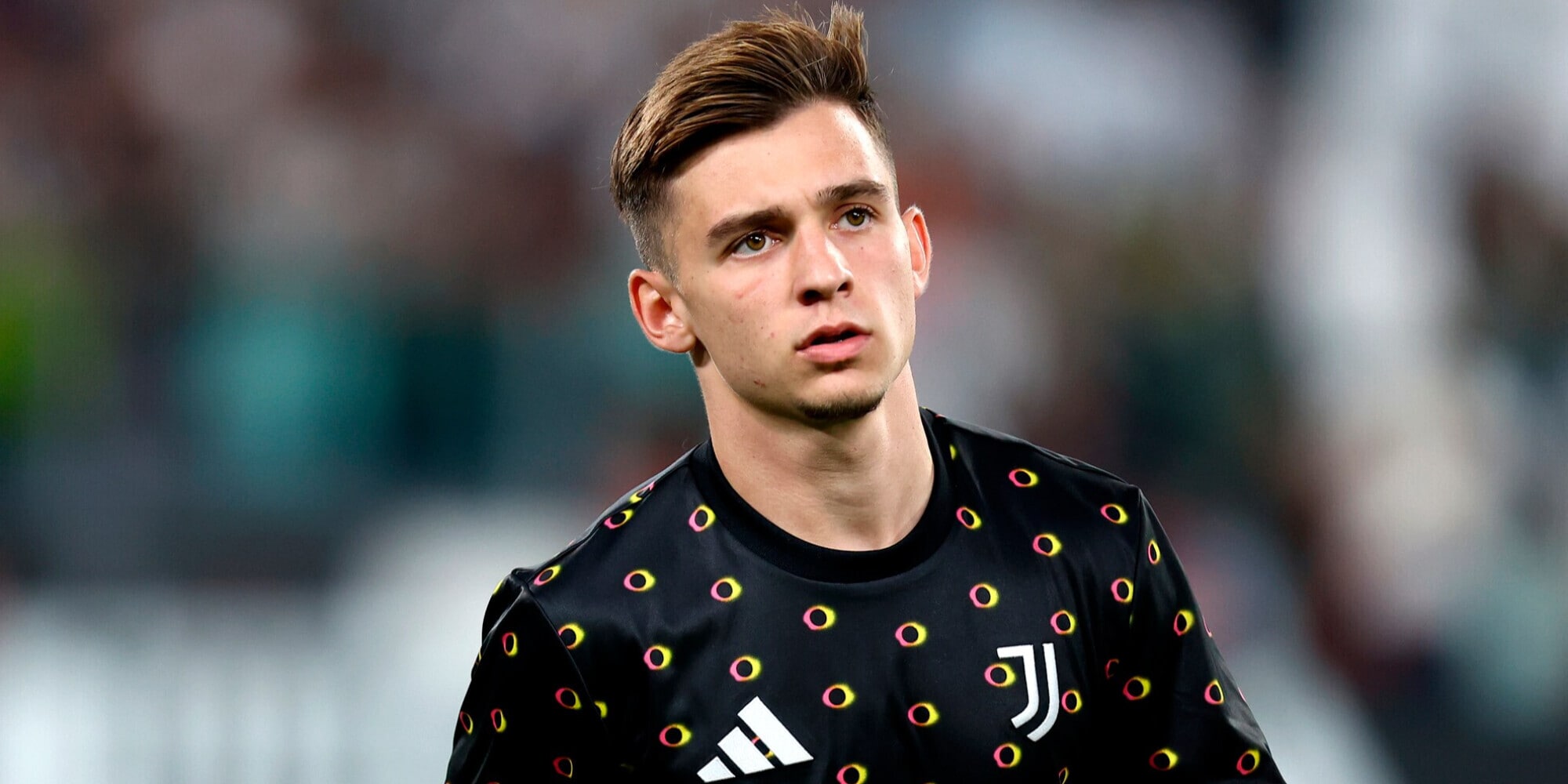 Conceicao, la nota Juve sull’infortunio: per quanto tempo starà fuori