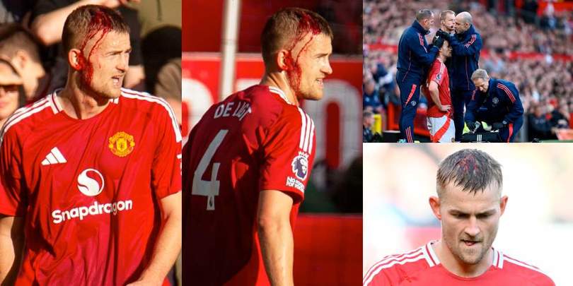 De Ligt guerriero: maschera di sangue ma senza turbante non è Chiellini