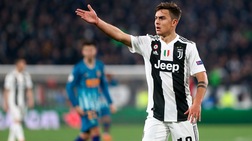 Juventus, ecco la formazione scelta da Allegri per la sfida con il Genoa