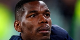 Juve, no Pogba. Così non si fa
