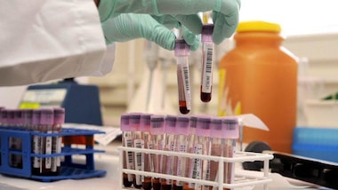 Atletica: 3 squalifiche per doping in Etiopia, ma i nomi sono top secret