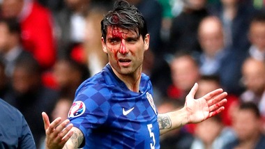 Turchia-Croazia, paura per Corluka: brutta ferita alla testa