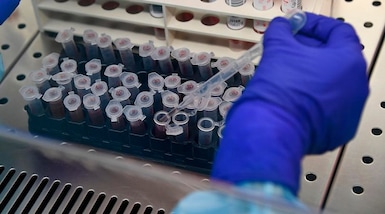 Coronavirus, vaccino: 1 italiano su 2 sarebbe poco propenso a farlo