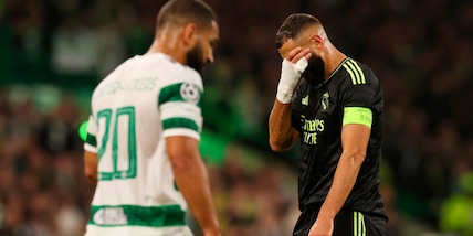 Infortunio Benzema, il Real rivela: "Ecco di cosa si tratta"