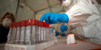 Long Covid, chi rischia di più? Può svelarlo un test del sangue