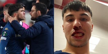 Bianco, naso rotto da invasore turco: incredibile in Sivasspor-Fiorentina