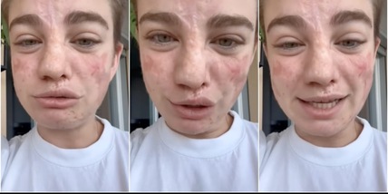 Bebe Vio derubata, l'appello: "Tenete tutto ma ridatemi la tesi di laurea"