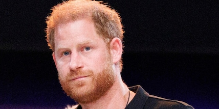 Harry, il volto del principe diventa... un livido. Racconto e foto virali