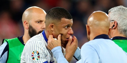Mbappé, niente operazione al naso: "Idee per una maschera?"