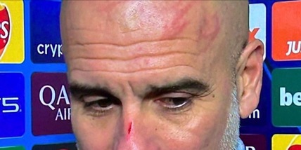 Guardiola shock si presenta ridotto così: “Voglio farmi male”