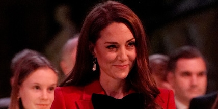 Kate Middleton, altro intervento tenuto segreto: la cicatrice sulla testa