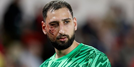 Donnarumma e il fallo shock, a Singo offese razziste. Il Monaco non ci sta