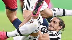 Juventus, il nuovo rivale è l'infermeria