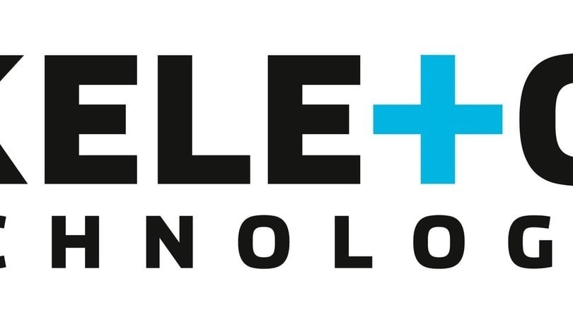 Skeleton Technologies, obiettivo ricarica elettrica in 15 secondi