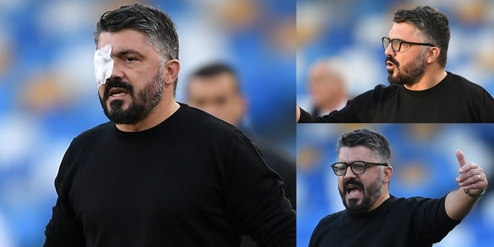 Gattuso con l’occhio coperto in Napoli-Sampdoria