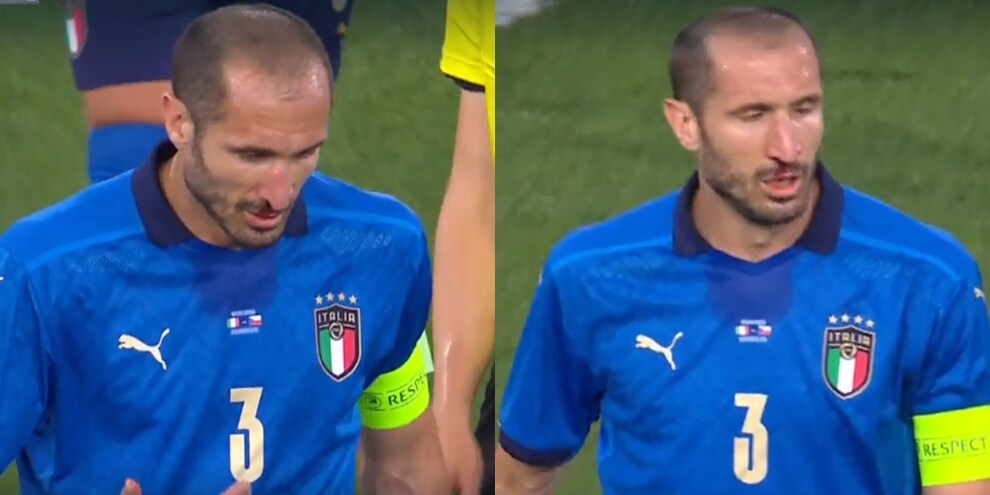 Italia-Repubblica Ceca, sangue dal naso per Chiellini