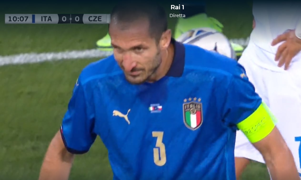 ItaliaRepubblica Ceca, sangue dal naso per Chiellini