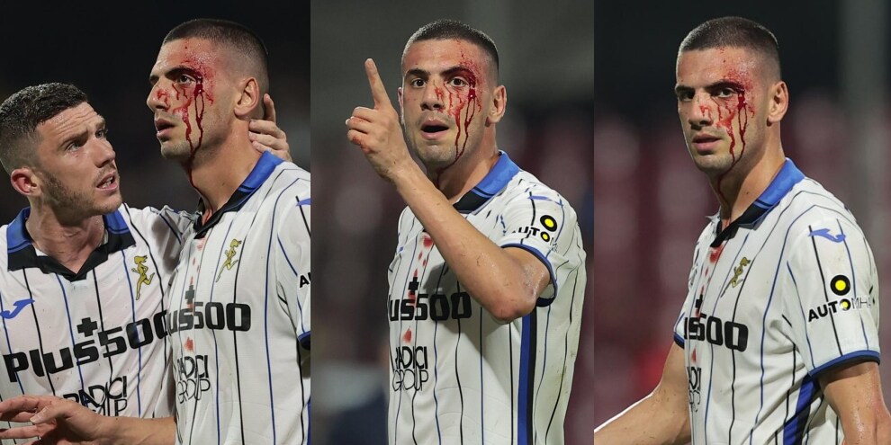 Salernitana-Atalanta, Demiral viene colpito al volto e esce dal campo insanguinato FOTO