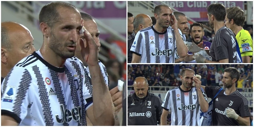 Juve, Chiellini ferito e sostituito dopo lo scontro con Piatek