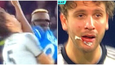 Locatelli maschera di sangue e il 3-1 Napoli: la protesta Juve, cos'è successo