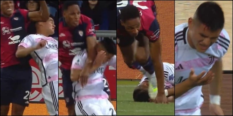 Alcaraz, gomitata di Mina in area e sangue dalla testa: silenzio di arbitro e Var