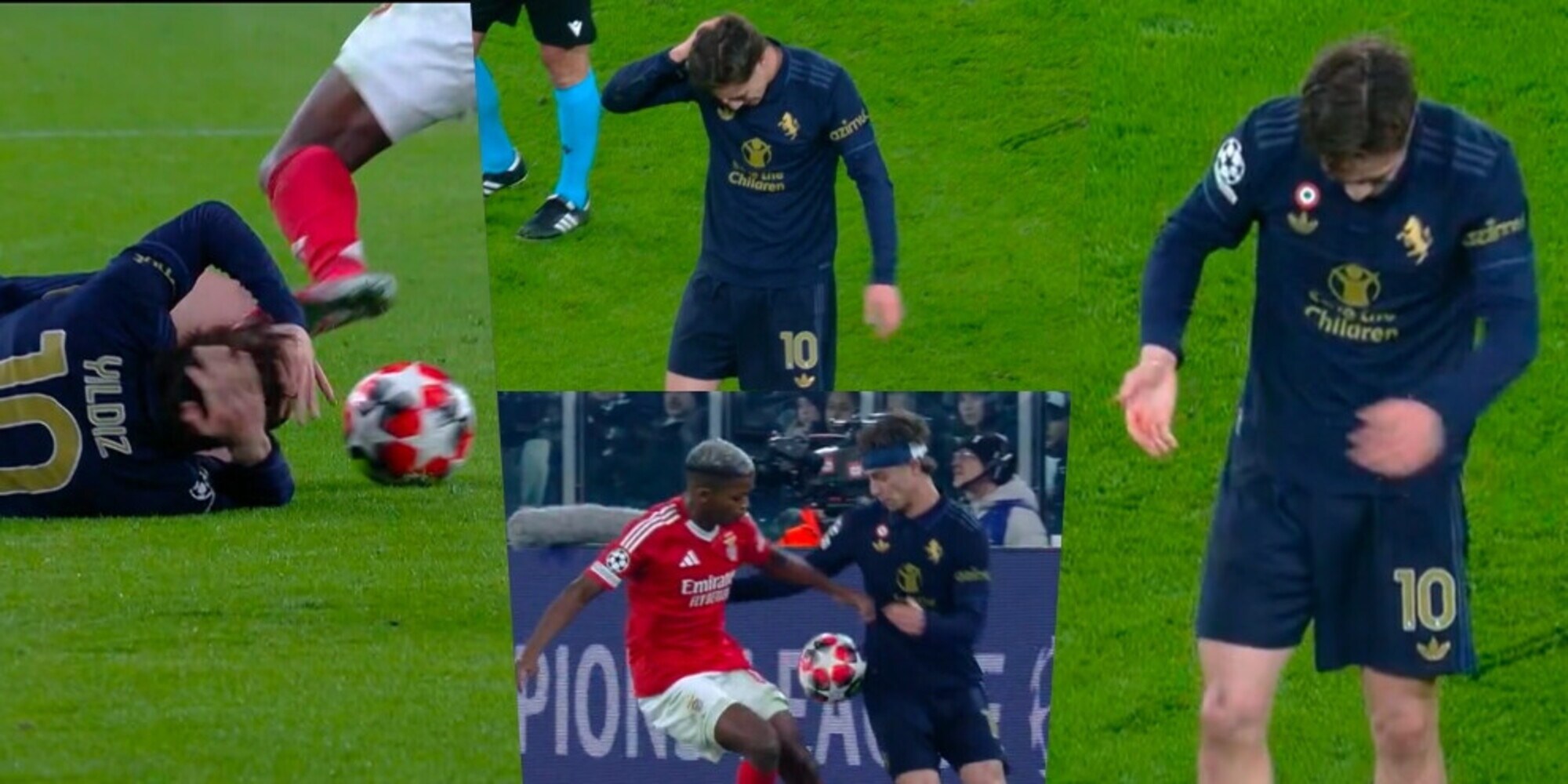 Yildiz, scarpata in testa e sangue: in campo col turbante alla Chiellini