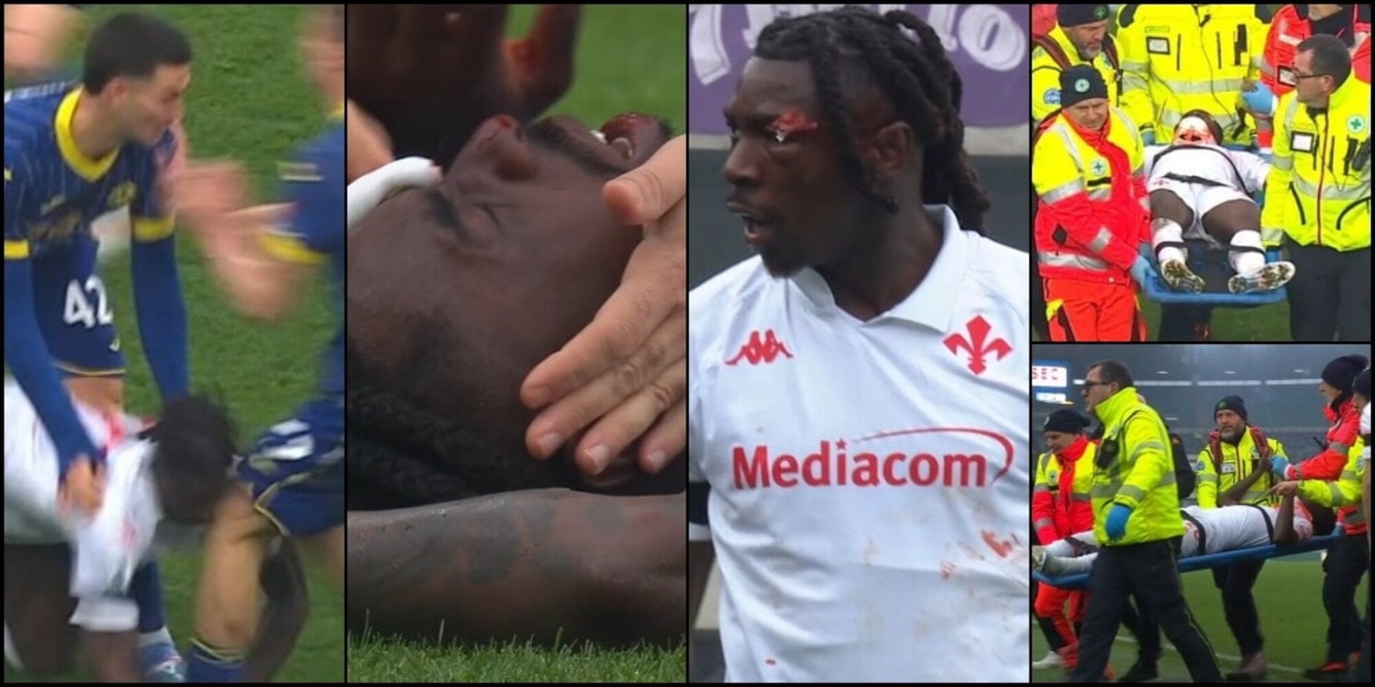 Paura Kean, ginocchiata e viso sanguinante: costretto a uscire in barella