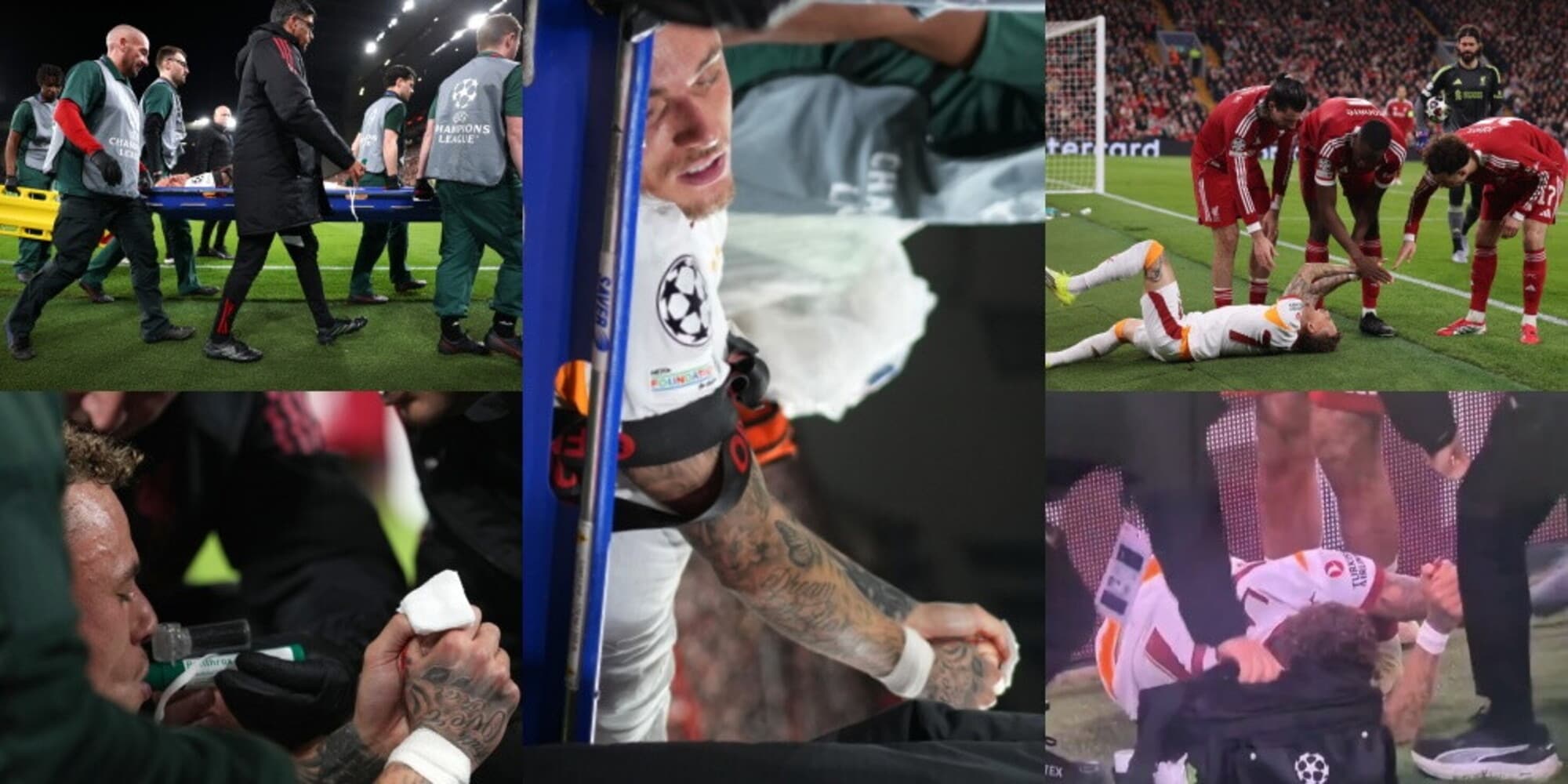 Lang splatter, lacrime e sangue: sbatte contro il cartellone pubblicitario e si squarcia il dito
