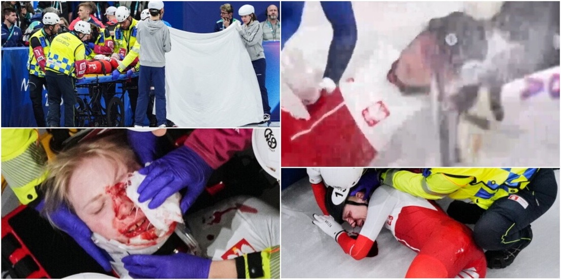 Sellier, tragedia sfiorata alle Olimpiadi: lama sull’occhio e volto ricoperto di sangue