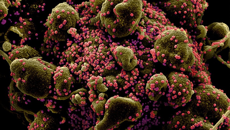Dagli Usa: "Il Coronavirus circolava da anni"