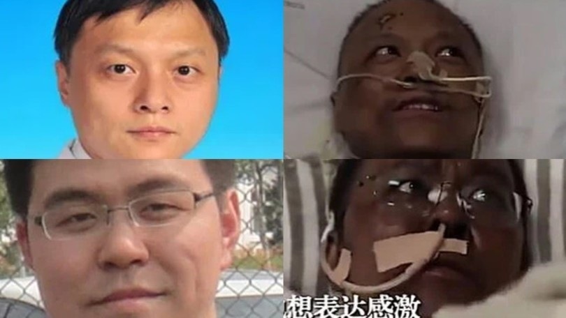 Dalla Cina: "Coronavirus, due medici si sono risvegliati con la pelle scura"