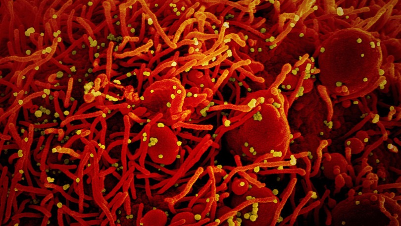 Coronavirus, in Italia circolava da prima dell'epidemia: ecco la conferma