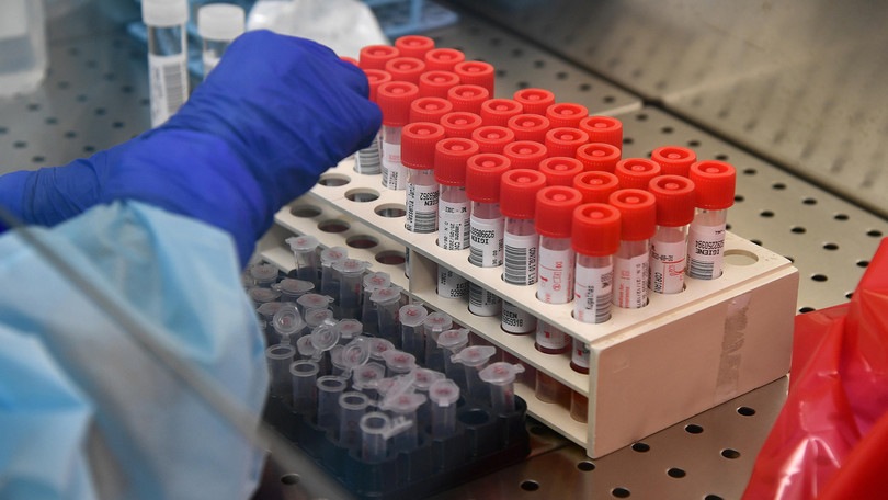 Coronavirus, polvere di staminali per guarire i danni ai polmoni