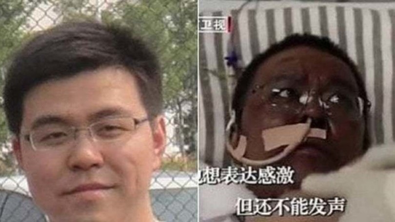 Coronavirus, muore in Cina il medico che si era risvegliato con la pelle nera