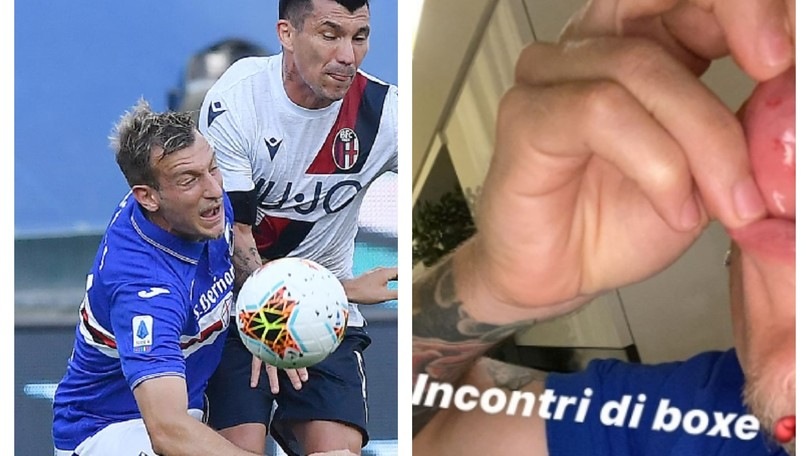 Sampdoria, La Gumina scherza sulla ferita alla bocca: "Incontri di boxe"