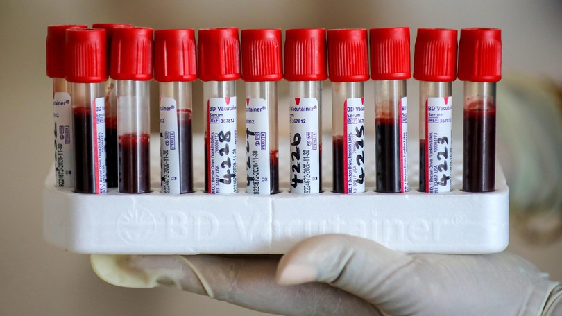 Coronavirus, paura in Ligue 1 per la ripartenza: quattro club con positivi