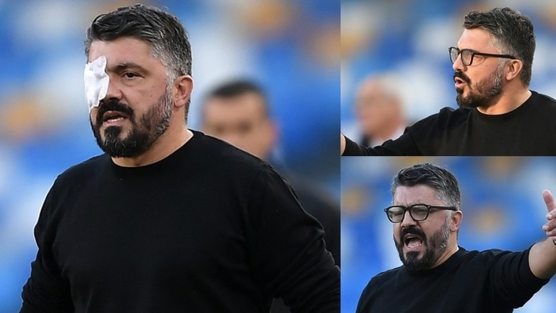 Gattuso con l’occhio coperto in Napoli-Sampdoria